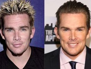Mark McGrath before and after plastic surgery (20)