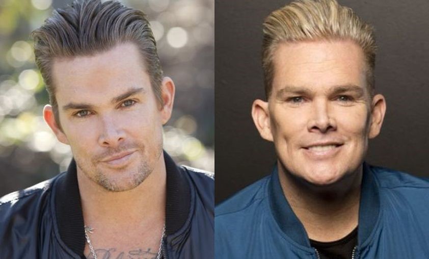 Mark McGrath before and after plastic surgery