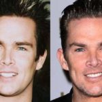 Mark McGrath before and after plastic surgery (9)