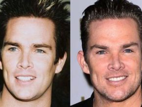 Mark McGrath before and after plastic surgery (9)