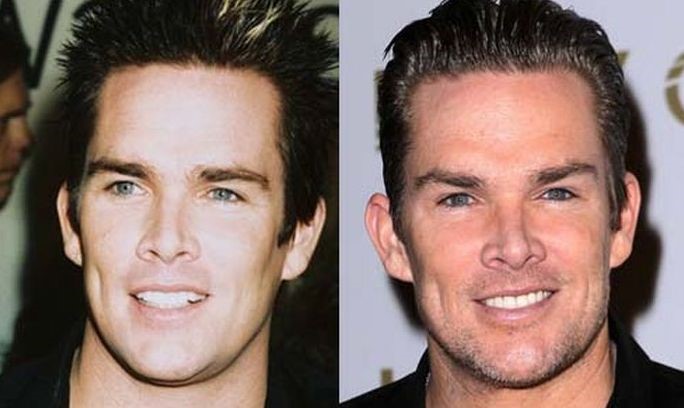 Mark McGrath before and after plastic surgery (9) .