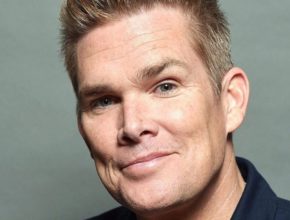 Mark McGrath plastic surgery (12)