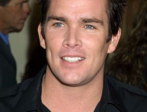 Mark McGrath plastic surgery (3)