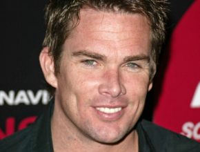 Mark McGrath plastic surgery (5)