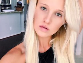 Tomi Lahren plastic surgery (18)