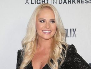 Tomi Lahren plastic surgery (21)