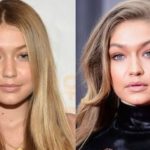 Gigi Hadid before after plastic surgery (24)