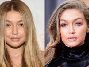 Gigi Hadid before after plastic surgery (24)