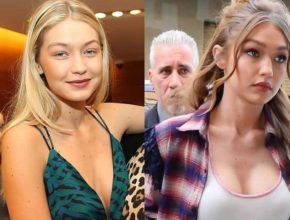 Gigi Hadid before and after plastic surgery