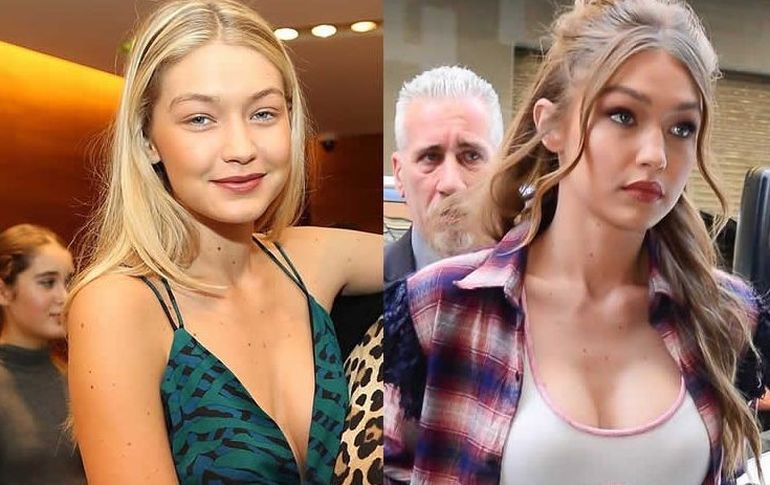Gigi Hadid before and after plastic surgery