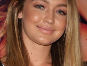 Gigi Hadid plastic surgery (15)