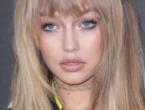 Gigi Hadid plastic surgery (23)