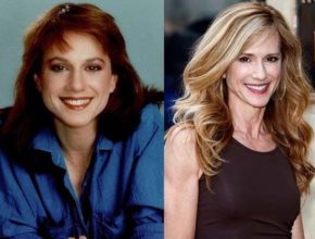 Holly Hunter before and after plastic surgery