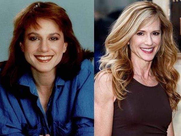 Holly Hunter before and after plastic surgery