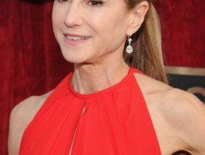 Holly Hunter plastic surgery (24)