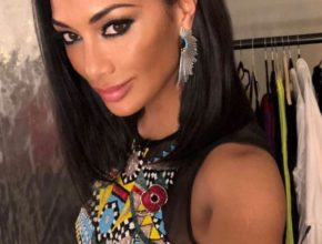 Nicole Scherzinger plastic surgery (37)