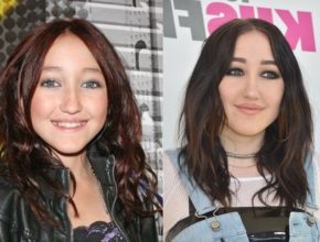 Noah Cyrus before and after plastic surgery
