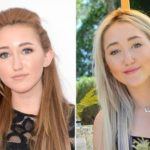 Noah Cyrus before and after plastic surgery (6)
