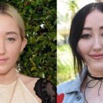 Noah Cyrus before and after plastic surgery (26)