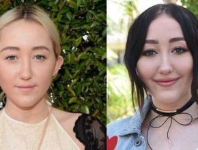 Noah Cyrus before and after plastic surgery (26)