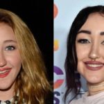 Noah Cyrus before and after plastic surgery (6)