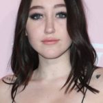 Noah Cyrus plastic surgery (10)