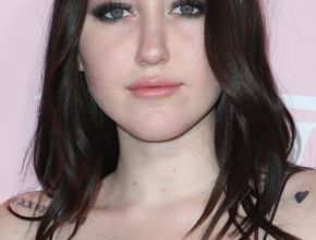 Noah Cyrus plastic surgery (10)