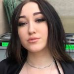 Noah Cyrus plastic surgery (14)