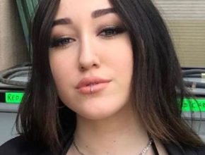 Noah Cyrus plastic surgery (14)