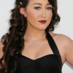 Noah Cyrus plastic surgery (24)