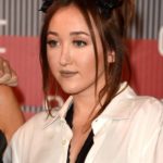 Noah Cyrus plastic surgery (27)