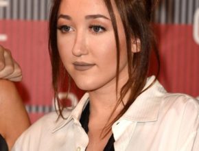 Noah Cyrus plastic surgery (27)