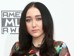 Noah Cyrus plastic surgery (3)