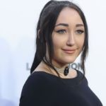 Noah Cyrus plastic surgery (33)