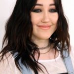 Noah Cyrus plastic surgery (9)